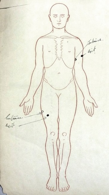 Edward Brittain's wounds recorded in his service record. (National Archives WO339/27827)
